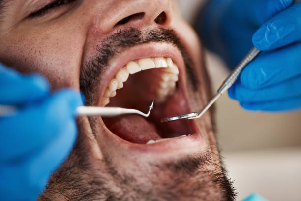 Professional Emergency Dentist in UT